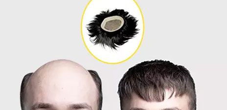 Hair Patch