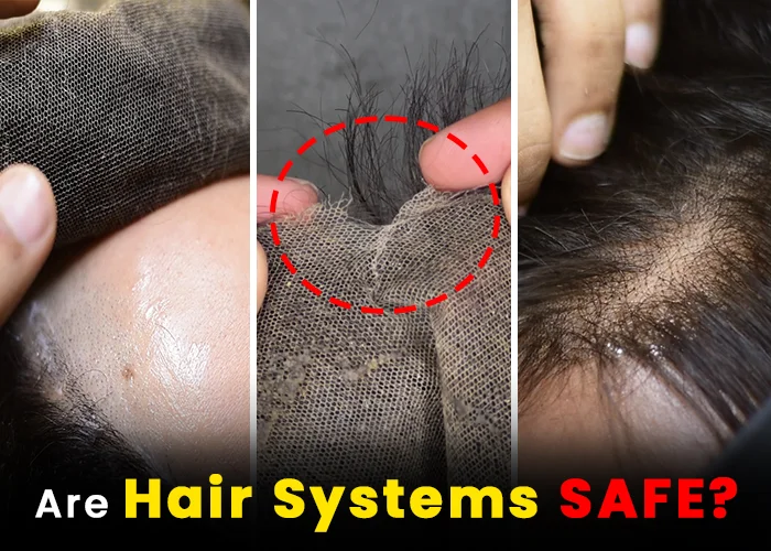 Are Patches for Hair Safe?